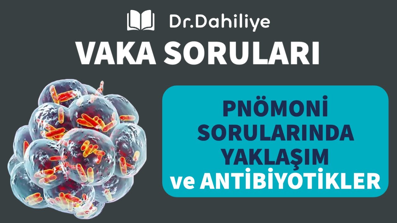 Vaka Soruları Örnek Videoları